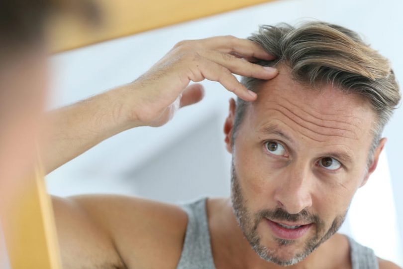 Haartransplantation Geheimratsecken Türkei